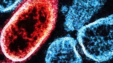 virus Nipah